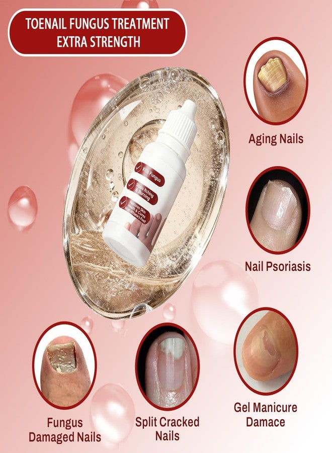 DERMFREE Fungi Nail Toenail Treatment Extra Strength,Toenail Renewal Serum, Nail Conditioning Solution for Thick&Discolored Nails, Quick-Dry Dropper, Safely & Gently for Healthier Nails, - Image 2